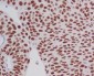 Anti-GATA3 Rabbit Monoclonal Antibody